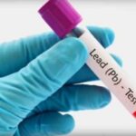 All Children in Illinois to Receive Blood Lead Testing